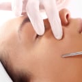 The Benefits of Dermaplaning: Long-Term Effects Explained