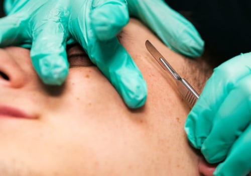 Dermaplaning: More Than Just Shaving Your Face